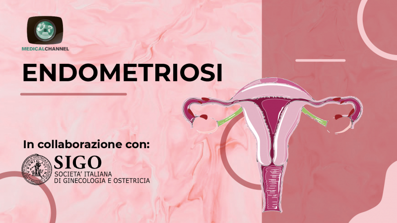 Endometriosi